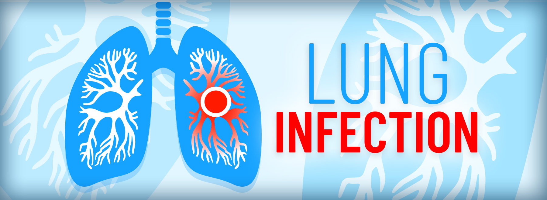 Visual depicting lung infections, highlighting pneumonia, its effects, and key information for understanding the condition.
